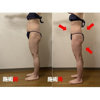 筋肉は重要