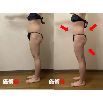 筋肉は重要